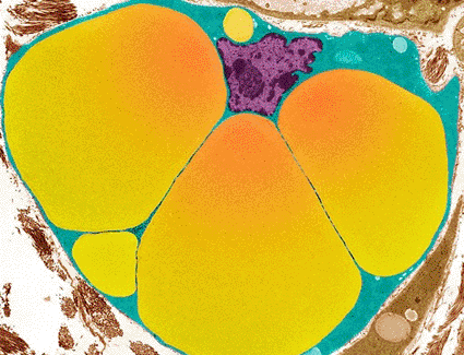 Imagen: Microfotografía electrónica de transmisión (TEM) a color de gotas de lípidos en una célula grasa en desarrollo (Fotografía cortesía de Steve Gschmeissner / SPL).